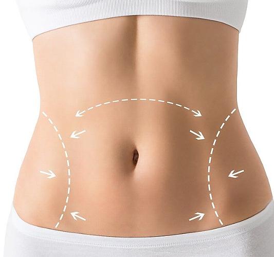 What do you need to know about Post-Surgery Lymphatic Drainage Massage? Cosmetic procedures such as a Tummy Tack, Breast Augmentation, or Liposuction can involve a long recovery period. Swelling, bruising and discomfort are common as the body heals after surgery. Your surgeon may also recommend lymphatic drainage massage to help reduce swelling, encourage fluid movement and improve comfort during the healing process.